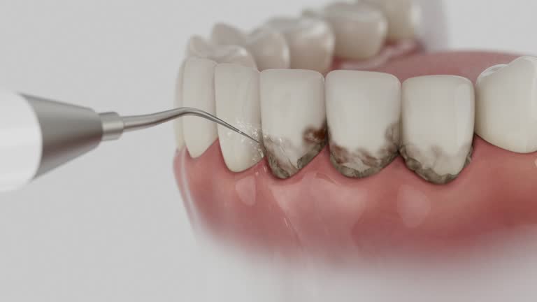 Reliable Teeth Whitening contractor in Macomb County County, MI by Dentist Open Now